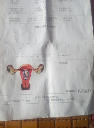 输卵管通液曲线图