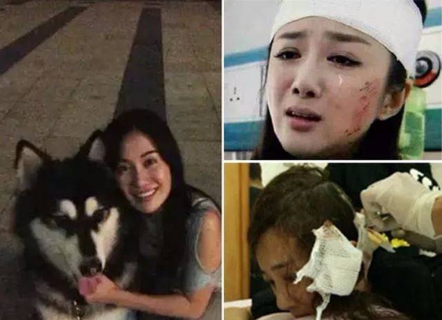 事发一年后,李依晓起诉叶璇,而当事人叶璇却屡次否认,斥责李依晓炒作