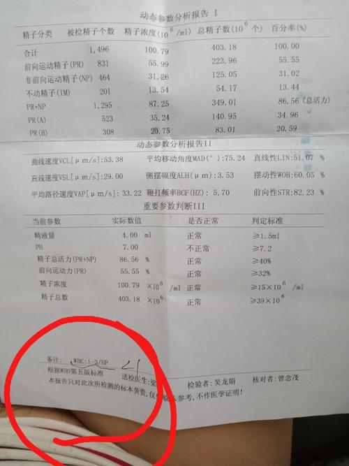 关于精子活力报告里的参数问题