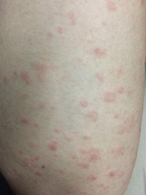 喝酒就这样 不知道什么情况 谁懂?