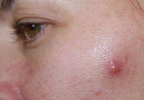 湿气最怕三种茶每天来一杯虚胖胃胀油脸远离你