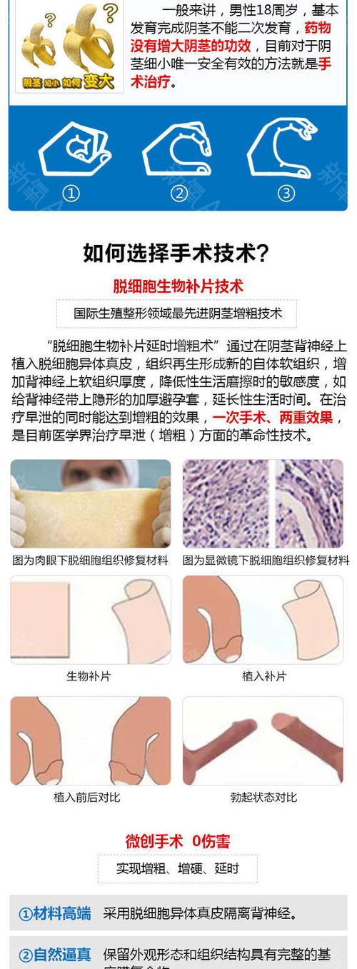 【阴茎增大】【三甲名医】私信送红包 真皮阴茎增大/生物补片/阴茎增
