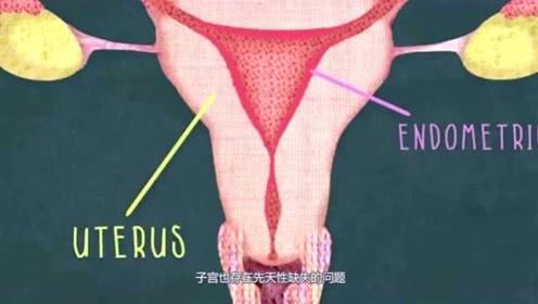 卵巢的是正常的,符合这样的特征的可以叫做石女