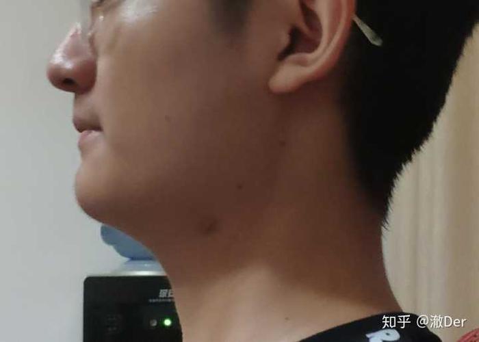 你的比我好多了,我连下颌线都不明显.