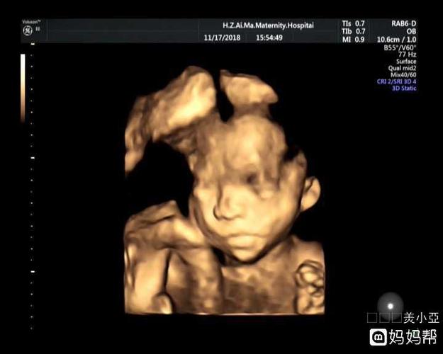 三胎啦,四维顺利通过.已知是女宝!