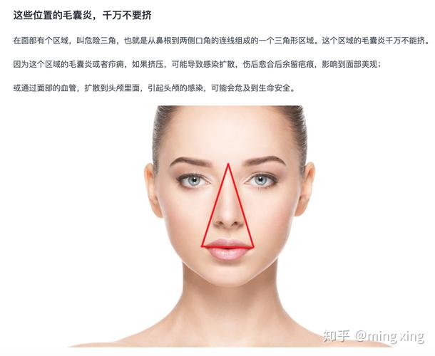 所谓面部危险三角区的真相到底是什么