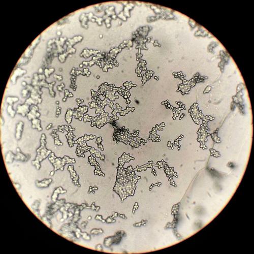 显微摄影——热带假丝酵母