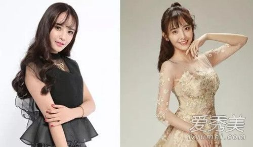 抖音兔子牙整容了吗 抖音兔子牙整容前后照片对比