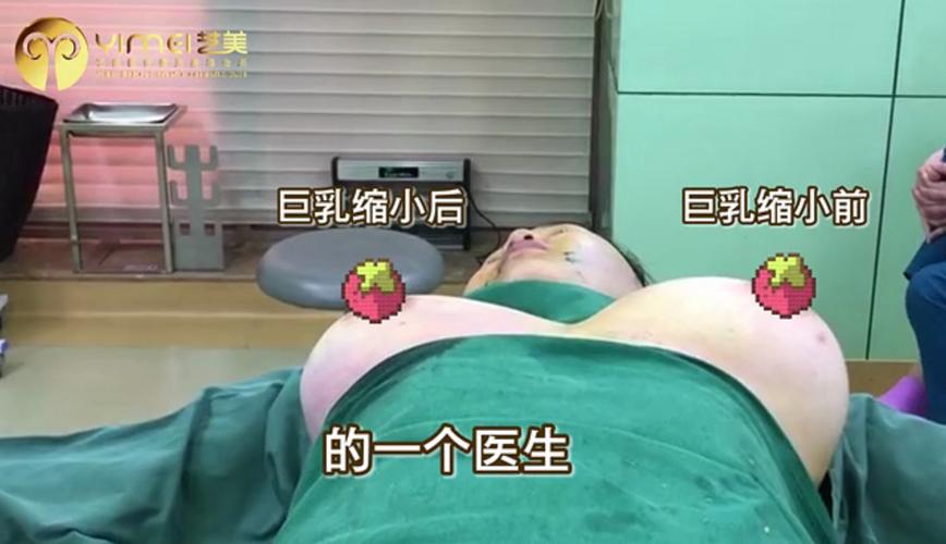 胸部怎么变小?不开刀巨乳缩小术