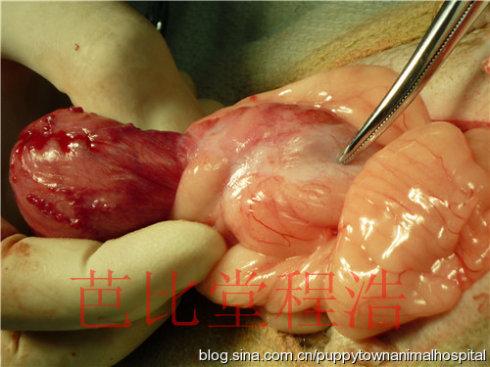 [转载]一例子宫残端积脓卵巢异常膀胱结石病例