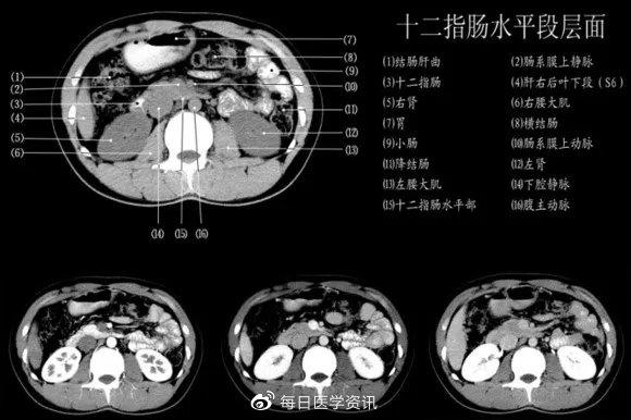 收藏腹部正常ct