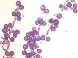 白色念珠菌感染器官分布及药敏实验分析