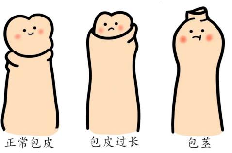 一刀下去救命啊阳湖二院救治一自割包皮的小伙