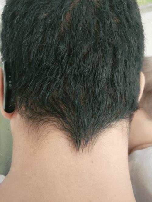 生活中,很多大人和小孩子的头发都会呈现这样的形态,后脑勺发尾处尖尖