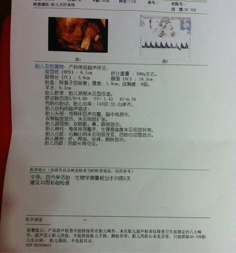 已生了女宝的四维单子图片,帮忙看一下四维彩超单,是