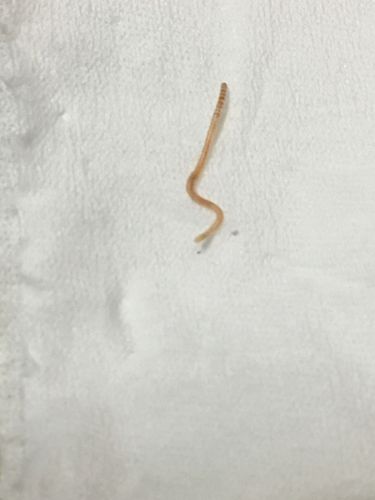 是蚯蚓幼虫?寄生虫?有没有这