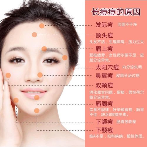 每战必殆"嘛, 我们首先是要分析原因才能找到合适的解决办法 痘痘的