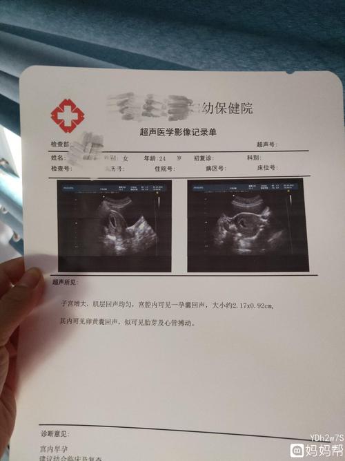 谁能帮我看看我这大概怀孕多长时间了,做个彩超