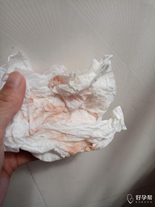 同房出血了怎么回事呢