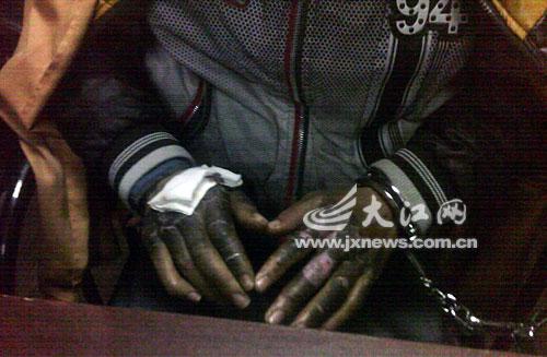 这双烧黑的手是对盗窃的惩罚