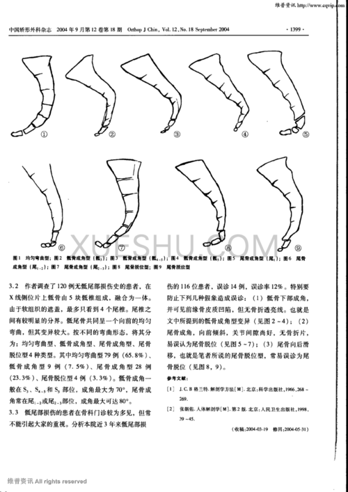 骶尾骨正常变异的影像学分析