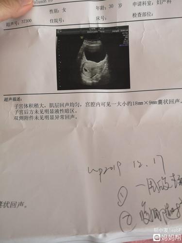 42天左右的的孕囊,不像也不圆润,能看男