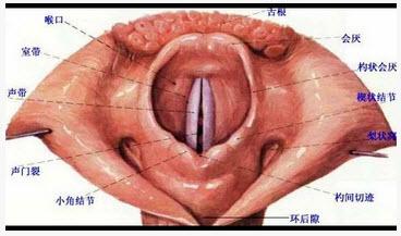 会厌呈u形或v形