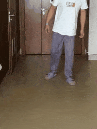 (术前患者腰椎姿势性侧弯,跛行步态)