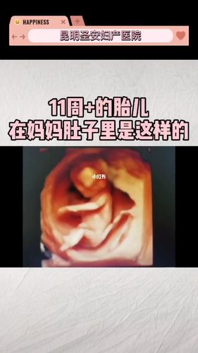 11周 的宝宝在妈妈肚子里是这样的727272_育儿经_辣妈_辣妈育儿