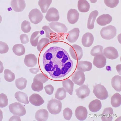 嗜多色红细胞增多提示骨髓中红细胞系统造血功能活跃,见