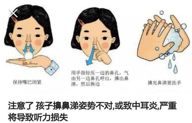 如何正确擤鼻涕