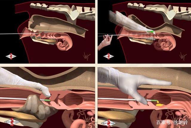 2,农区人工授精利于优良品种推广,防止畜群退化,产羔,产犊易于管理.