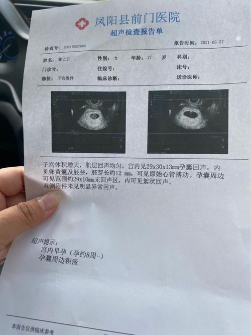 [试管婴儿]都说孕囊看男女,我这能看出男孩