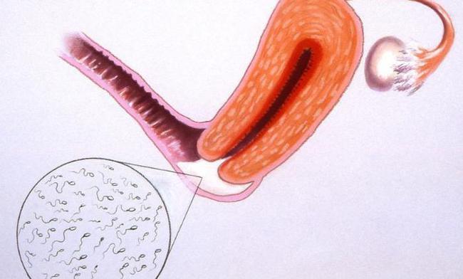 专家称同房之后,子宫后位的女性可以采取俯卧的姿势帮助受孕,而后入