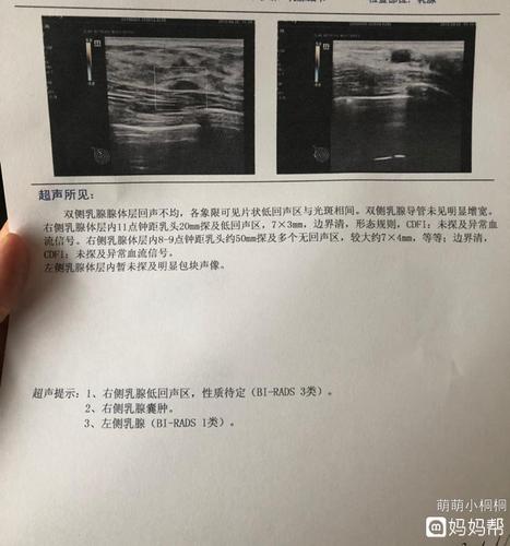 宝妈们乳腺囊肿建议手术吗?