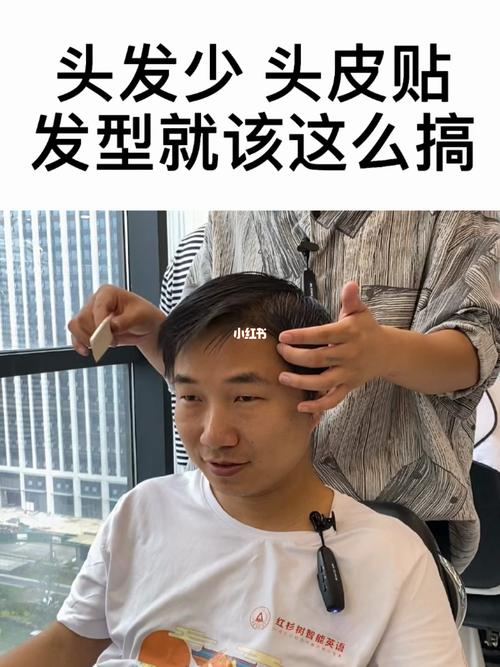 头发少,头皮贴男士发型就该这么搞_男士发型_top1 hair studio自由行