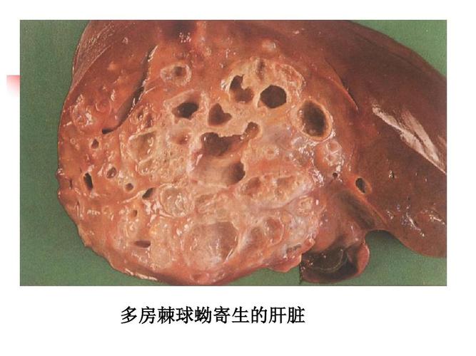 细粒棘球绦虫,多房棘球绦虫,曼氏迭宫绦虫ppt