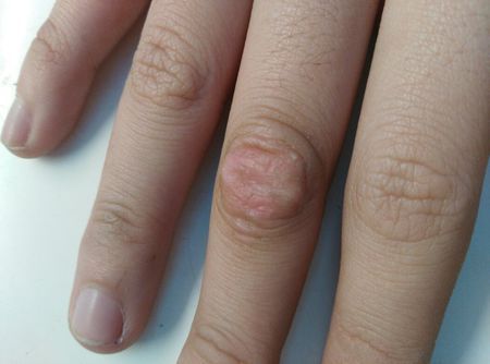 太难看了这指节垫,怎么弄掉啊.