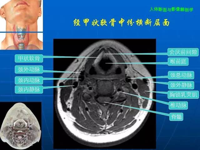 颈部断面与影像解剖
