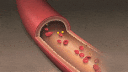 当心疾病找上门!