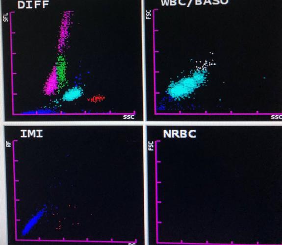 老年女性,慢性发病,血常规白细胞异常增多,且不分类,散点图diff通道