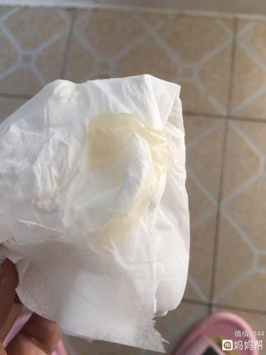 这是不是排卵期白带拉丝