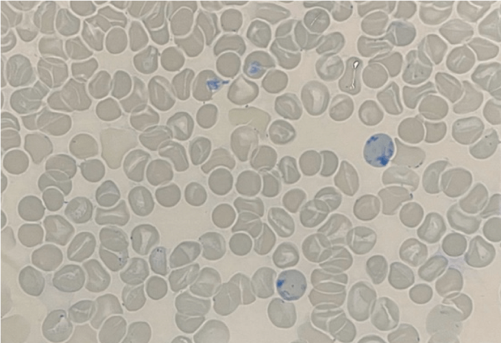 学术专题丨浅谈网织红细胞量值溯源67