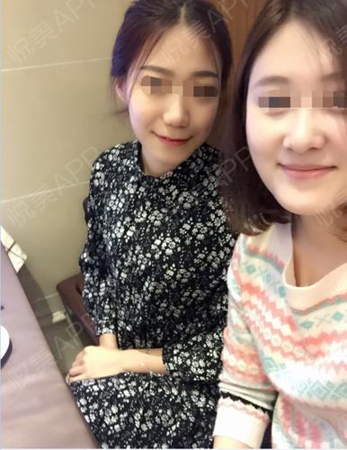 做手术缩阴8天了,身体没有什么不舒服的,就是刚做完.