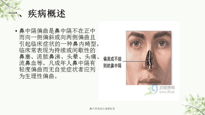 鼻中隔偏曲的健康教育课件