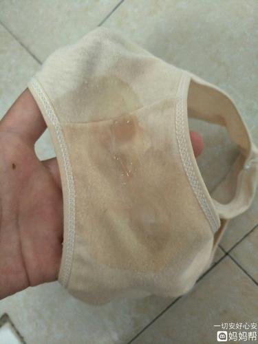 宝妈们帮忙看看这是不是羊水?