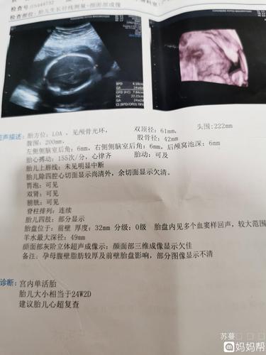 今天去做三维彩超 医生建议做胎儿心超