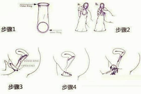 女性避孕膜使用图解1分钟学会避孕膜怎么用的方法