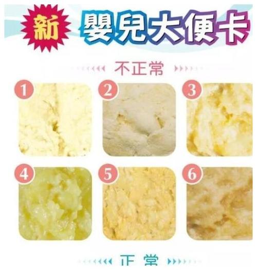 2,大便有泡沫有的宝宝大便里可能会出现一些泡沫,可能是肠胃不适导致