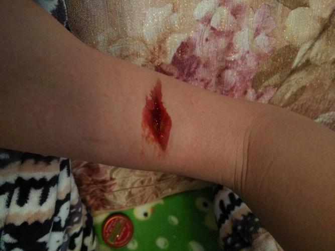 求ps大神在这条胳膊上p两条伤口,要有很多血,血色鲜红